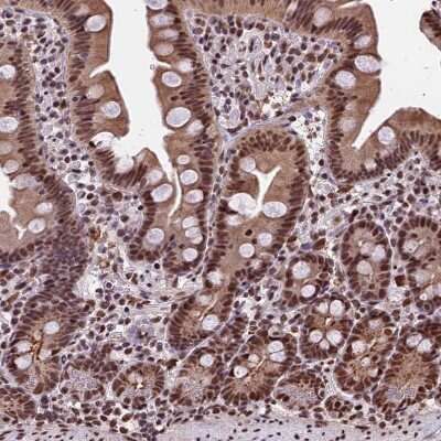 Immunohistochemistry-Paraffin: POLR3E Antibody [NBP1-84621]