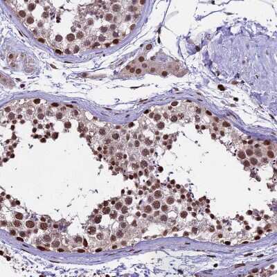 Immunohistochemistry-Paraffin: POLR3E Antibody [NBP1-84621]