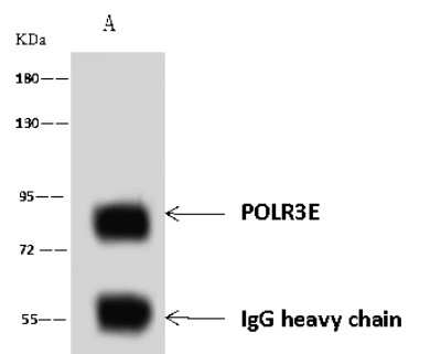 Immunoprecipitation: POLR3E Antibody [NBP2-97859]