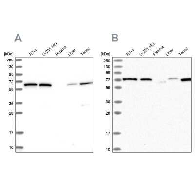 Western Blot: POLR3E Antibody [NBP1-84621]