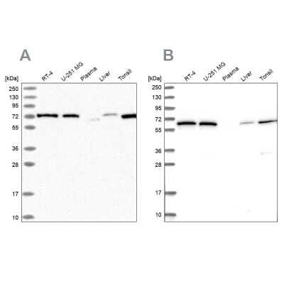 Western Blot: POLR3E Antibody [NBP2-58956]