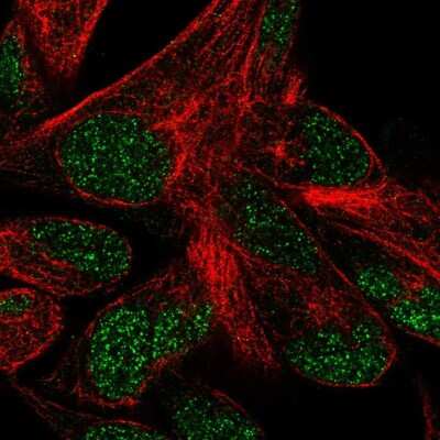 Immunocytochemistry/ Immunofluorescence: POLR3F Antibody [NBP2-56658]