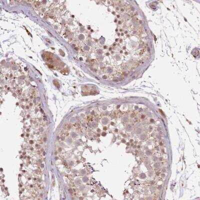 Immunohistochemistry-Paraffin: POLR3F Antibody [NBP2-47327]