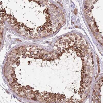Immunohistochemistry-Paraffin: POLR3F Antibody [NBP2-47328]