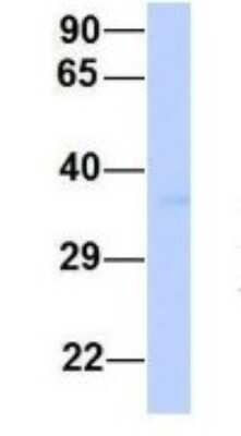 Western Blot: POLR3F Antibody [NBP1-52916]