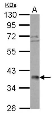 Western Blot: POLR3F Antibody [NBP2-19888]