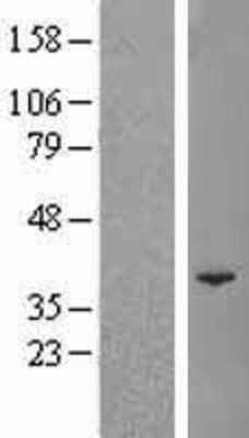 Western Blot: POLR3F Overexpression Lysate [NBL1-14593]