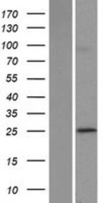 Western Blot: POLR3G Overexpression Lysate [NBP2-07616]