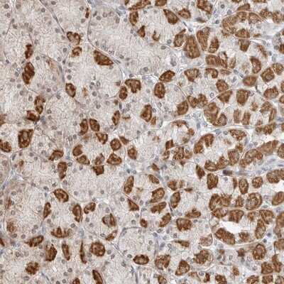 Immunohistochemistry-Paraffin: POLR3GL Antibody [NBP1-81997]
