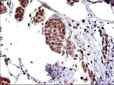 Immunohistochemistry: POLR3GL Antibody (OTI5E8) [NBP2-45367]