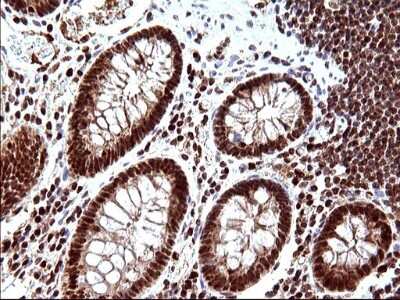 Immunohistochemistry: POLR3GL Antibody (OTI5E8) [NBP2-45367]