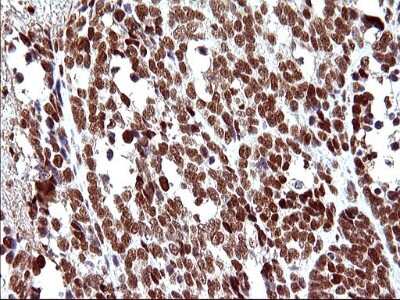 Immunohistochemistry: POLR3GL Antibody (OTI5E8) [NBP2-45367]
