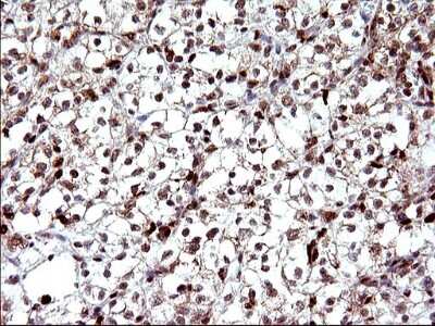 Immunohistochemistry: POLR3GL Antibody (OTI5E8) [NBP2-45367]