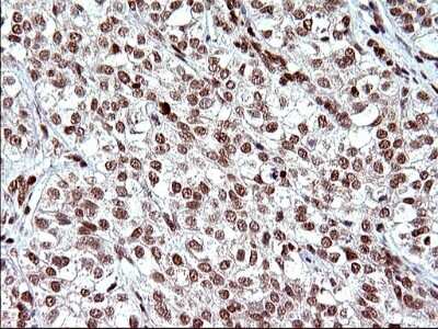 Immunohistochemistry: POLR3GL Antibody (OTI5E8) [NBP2-45367]