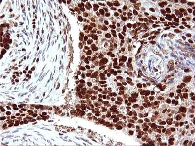 Immunohistochemistry: POLR3GL Antibody (OTI5E8) [NBP2-45367]