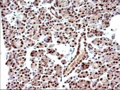 Immunohistochemistry: POLR3GL Antibody (OTI5E8) [NBP2-45367]
