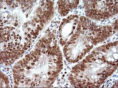 Immunohistochemistry: POLR3GL Antibody (OTI5E8) [NBP2-45367]