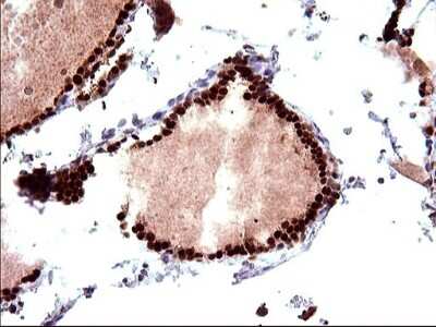 Immunohistochemistry: POLR3GL Antibody (OTI5E8) [NBP2-45367]