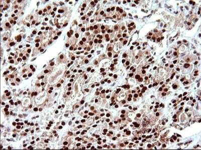 Immunohistochemistry: POLR3GL Antibody (OTI5E8) [NBP2-45367]