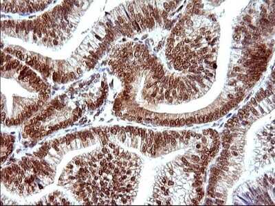 Immunohistochemistry: POLR3GL Antibody (OTI5E8) [NBP2-45367]