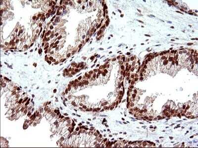 Immunohistochemistry: POLR3GL Antibody (OTI5E8) [NBP2-45367]