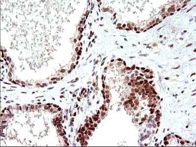 Immunohistochemistry: POLR3GL Antibody (OTI5E8) [NBP2-45367]
