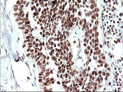Immunohistochemistry: POLR3GL Antibody (OTI5E8) [NBP2-45367]