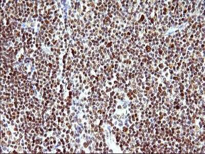 Immunohistochemistry: POLR3GL Antibody (OTI5E8) [NBP2-45367]