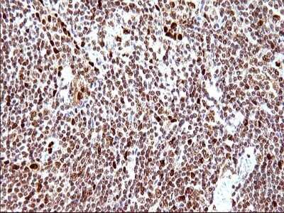 Immunohistochemistry: POLR3GL Antibody (OTI5E8) [NBP2-45367]