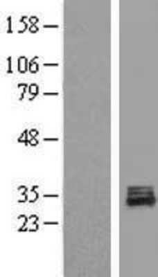 Western Blot: POLR3GL Overexpression Lysate [NBL1-14594]