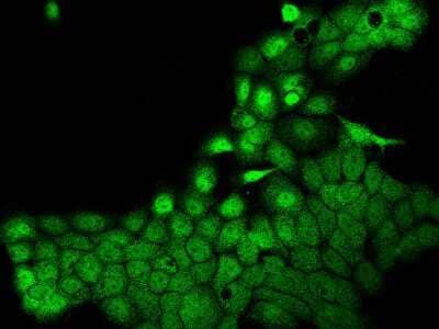 Immunocytochemistry/ Immunofluorescence: POLR3H Antibody [NBP2-98184]