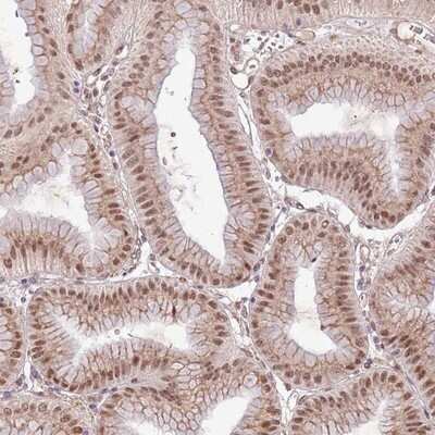 Immunohistochemistry-Paraffin: POLR3H Antibody [NBP2-13787]