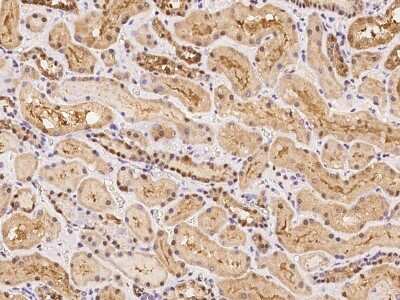 Immunohistochemistry-Paraffin: POLR3H Antibody [NBP2-98184]