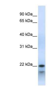 Western Blot: POLR3H Antibody [NBP1-53025]