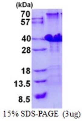 SDS-PAGE: Recombinant Human POLR3H His Protein [NBP2-23351]