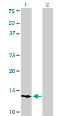 Western Blot: POLR3K Antibody (3F5) [H00051728-M01]