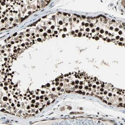 Immunohistochemistry-Paraffin: POLR3K Antibody [NBP1-80815]