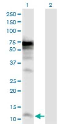 Western Blot: POLR3K Antibody [H00051728-D01P]