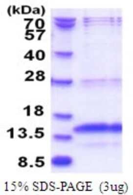 SDS-PAGE: Recombinant Human POLR3K His Protein [NBP2-51771]