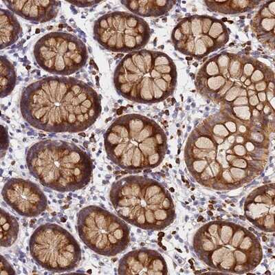 Immunohistochemistry-Paraffin: POM121 Antibody [NBP2-14531]