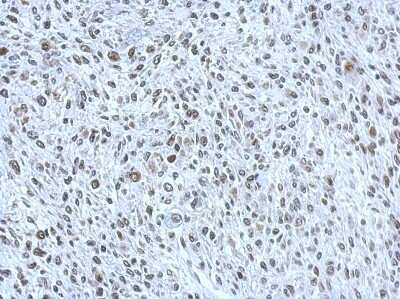 Immunohistochemistry-Paraffin: POM121 Antibody [NBP2-19890]