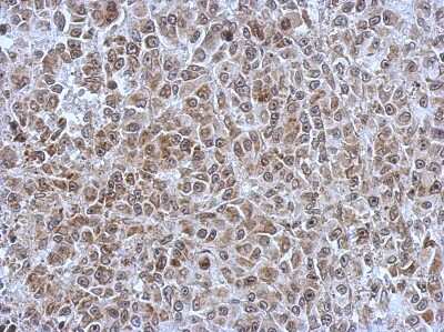 Immunohistochemistry-Paraffin: POM121 Antibody [NBP2-19890]