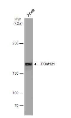 Western Blot: POM121 Antibody [NBP2-19890]