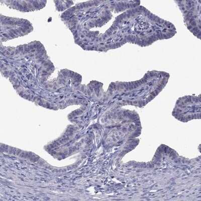 Immunohistochemistry-Paraffin: POM121L12 Antibody [NBP1-90526]