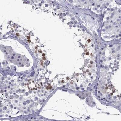 Immunohistochemistry-Paraffin: POM121L12 Antibody [NBP1-90526]