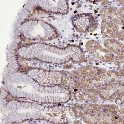 Immunohistochemistry-Paraffin: POM121L2 Antibody [NBP1-93443]