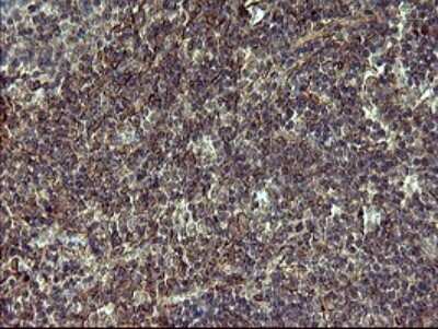 Immunohistochemistry: POMC Antibody (OTI2B2) [NBP2-45369]