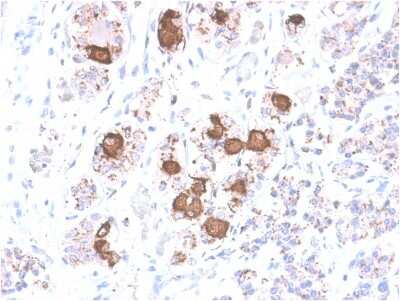 Immunohistochemistry-Paraffin: ACTH Antibody (CLIP/2040R) - Azide and BSA Free [NBP3-08621]