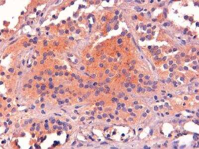 Immunohistochemistry-Paraffin: POMC Antibody [NB100-1533]