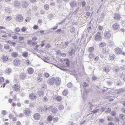 Immunohistochemistry-Paraffin: POMC Antibody [NBP2-55008]